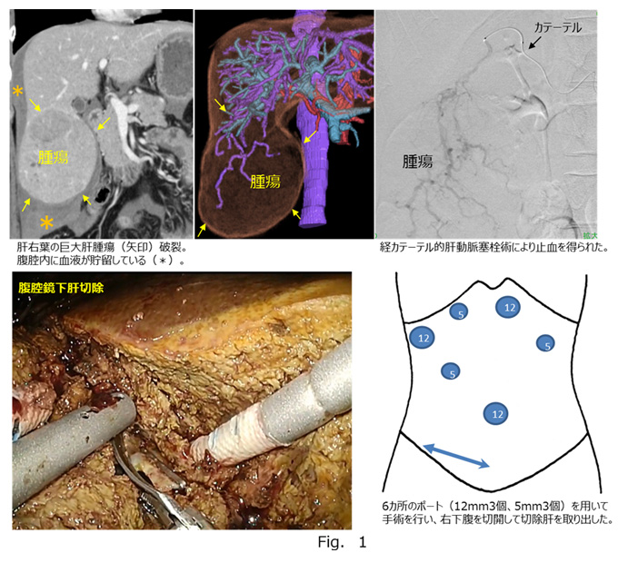 腹部外傷と聞いたら！ 3ページ目 ：Cadetto.jp