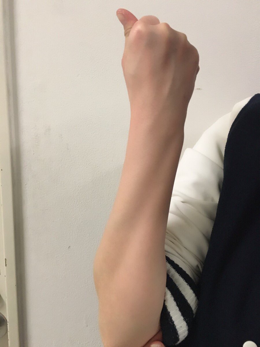 腕橈骨筋高津整体院