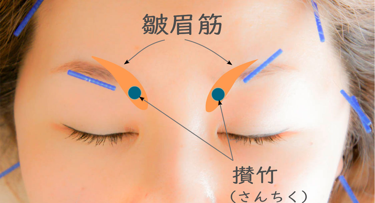 眉毛の位置で顔の印象は劇的に変わる！理想の美人眉を見つける方法トゥルーデザインクリニック