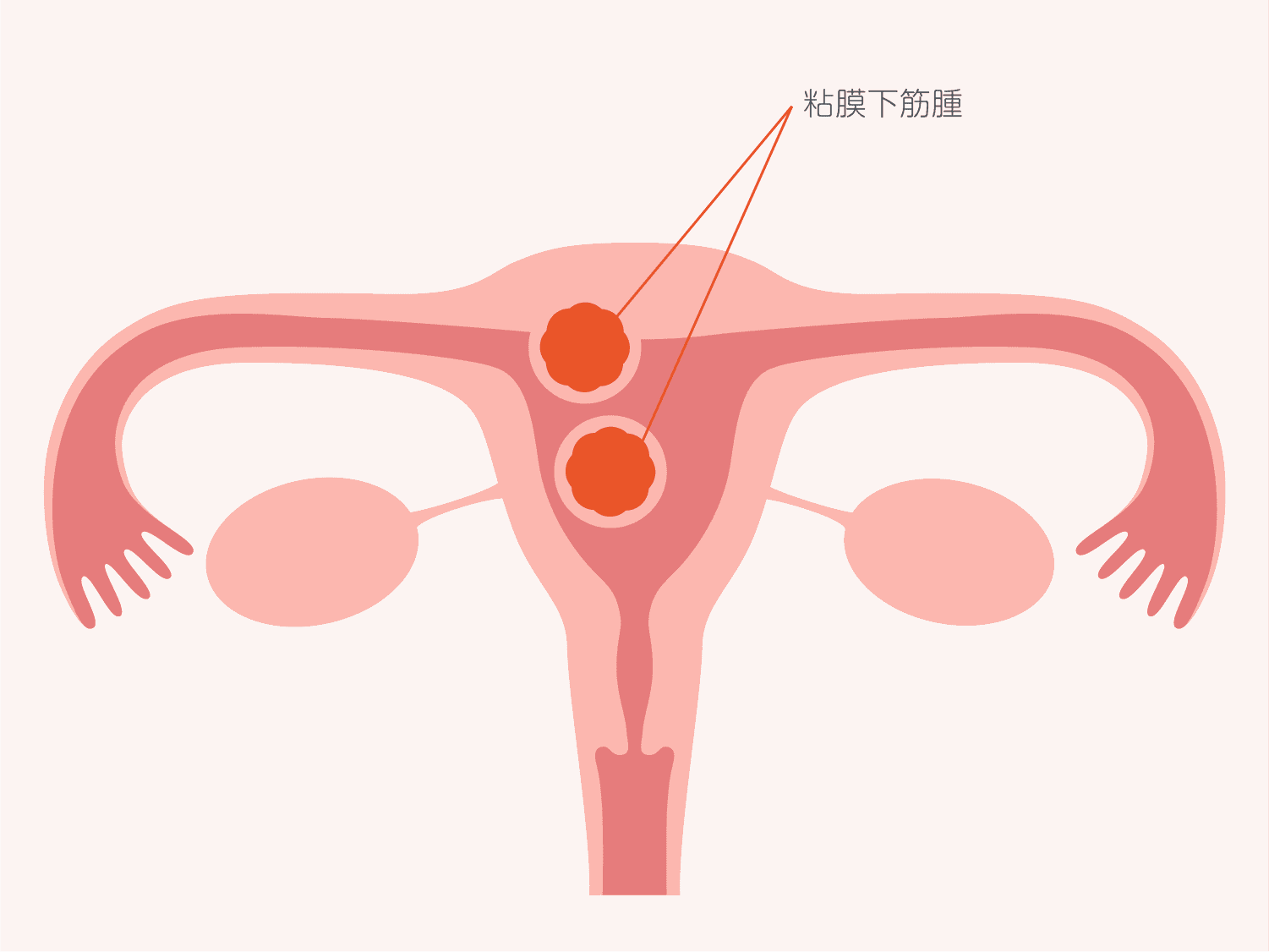 4.解剖学的内子宮口を 渡部信子 - 魔女のひとりごと