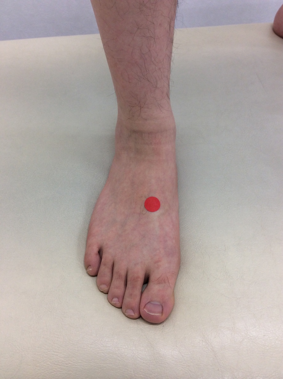 足の甲や足の指の痛み、これってリウマチ？」ブログさとう埼玉リウマチクリニック埼玉県戸田市のリウマチ科・リウマチ専門医のクリニック