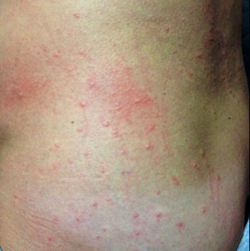 ほくろ・いぼ美容皮膚科渋谷スクランブル皮膚科渋谷駅徒歩1分