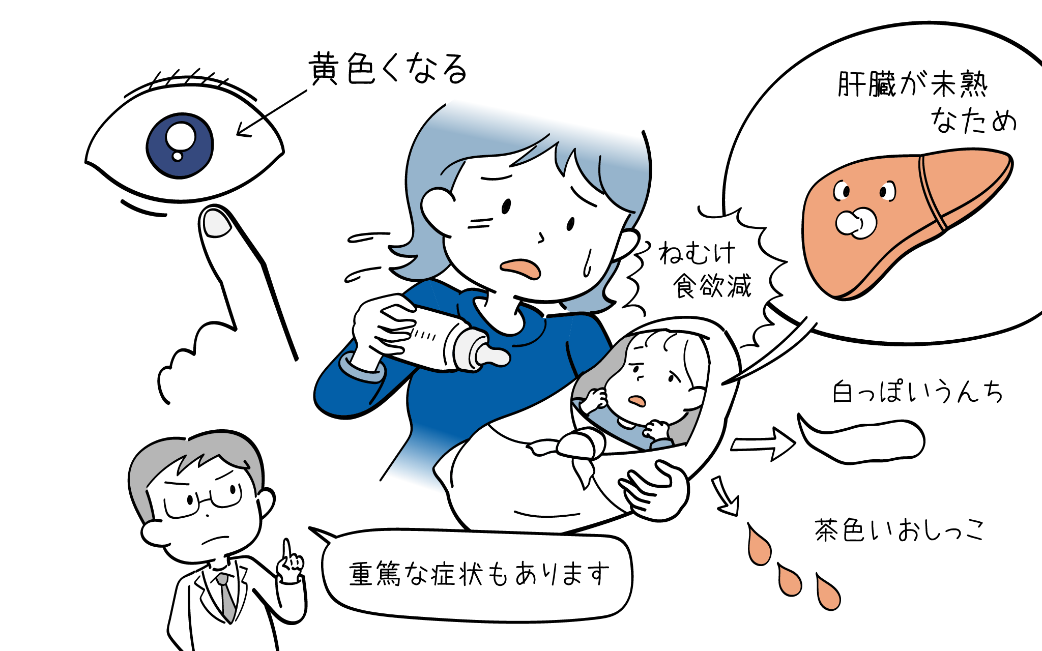 黄疸 総胆管結石、胆管炎: こどもの病気・おとなの病気