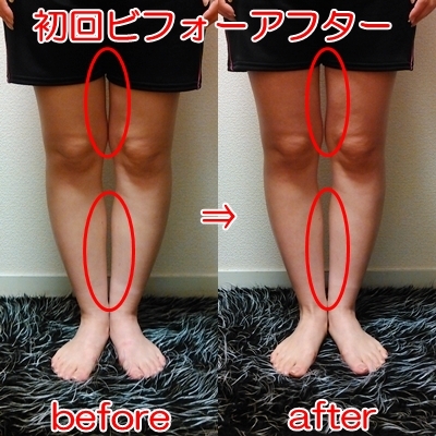 必ず痩せる♡脚痩せリンパマッサージ方法―28kg 公開ﾀﾞｲｴｯﾄ♡美BODY作り&体重維持中‼