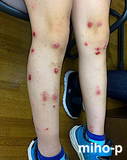 皮膚科の特色診療科・外来担当表日本赤十字社医療センター 渋谷区