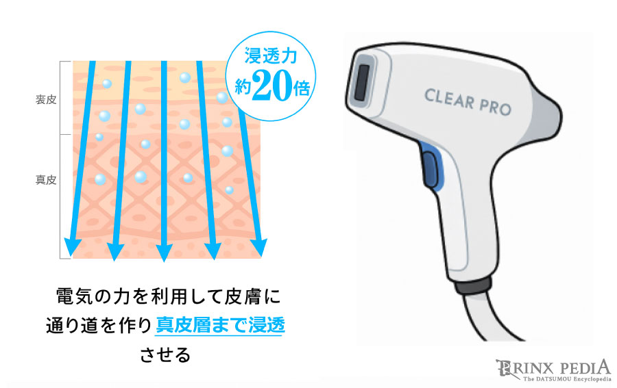 体験談多数掲載！ ストラッシュでの脱毛はやばい？やめたほうがいい？効果あるのか実際の口コミを紹介！10ヶ月無料のからくり最新のキャンペーン