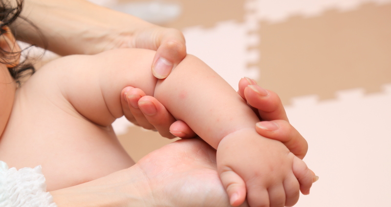 黄色ブドウ球菌による伝染性膿痂疹 飛び火・とびひ の治し方」のホームページを作りました。橋本クリニック ゆめタウン呉呉市 皮膚科