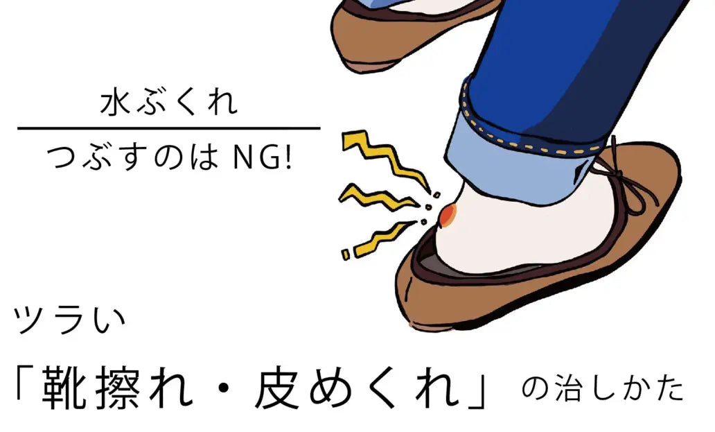 足の巨大な水ぶくれの解説