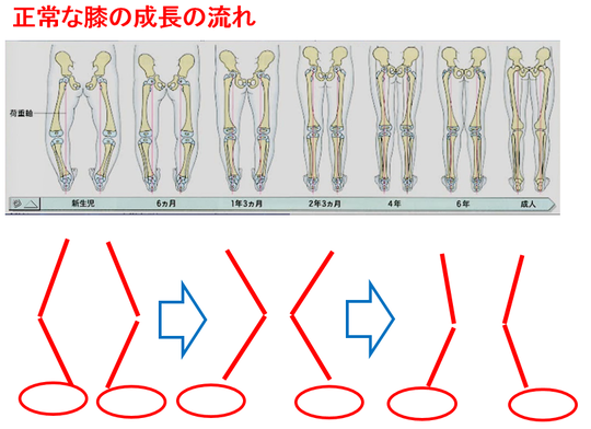 脚痩せしないのは、膝が伸び過ぎている反張膝が原因かも？ –名古屋・金山でパーソナルトレーニング 女性・ダイエット 猫背・腰痛・姿勢なら「sun-arch」へ