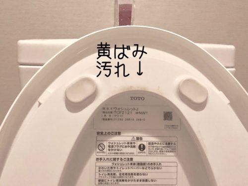 プロ直伝 便座裏ゴムの頑固な黄ばみをきれいに落とす簡単お掃除術4yuuu