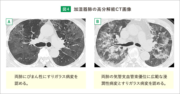 胸部聴診の目的医療法人 好友会 ひらたクリニック羽曳野市、古市駅の消化器内科・内視鏡内科・内科