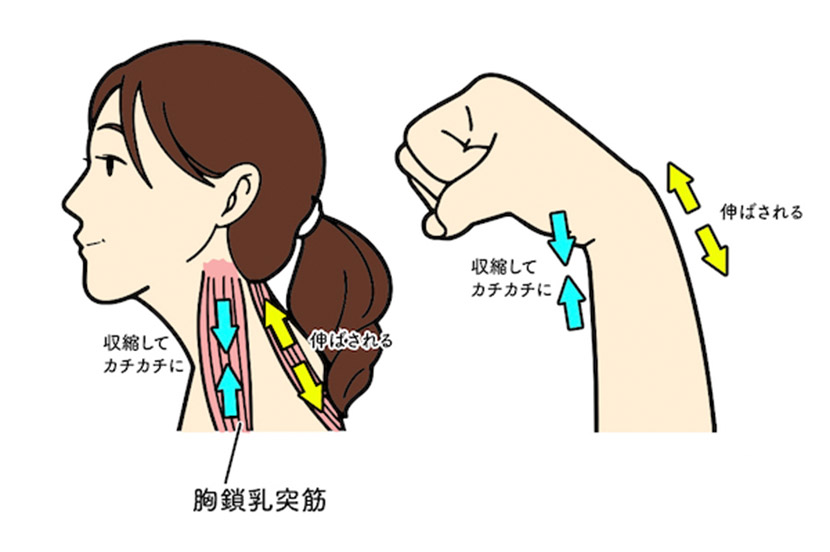 首矯正 前にでた首や頭・上がったアゴを治す1106 - YouTube