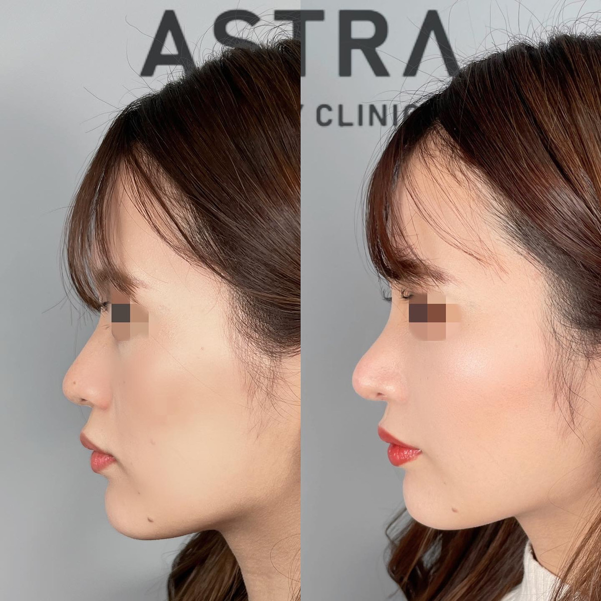 モデルプレス 横顔が美しい女性芸能人✨﻿ ﻿ 正面はもちろんのこと、横から見ても美しい 💖﻿ 女性芸能人の美しい横顔をまとめました🤗﻿ ﻿石原さとみ さん﻿橋本環奈 さん﻿白石麻衣 さん﻿菜々緒 さん﻿新木優子 さん﻿わたなべ麻衣 さん﻿中条あやみ さん﻿山下