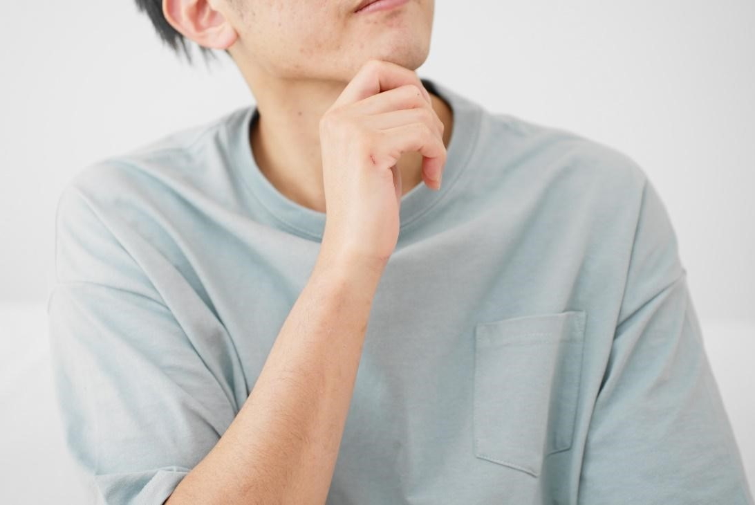 顎角栓 顎にとんでもない量の角栓が ！