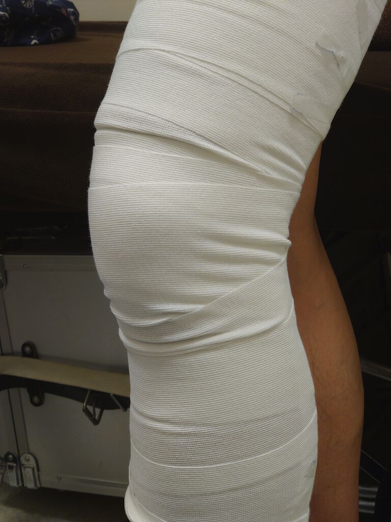 接骨院 志木膝蓋骨骨折