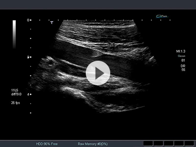 エキスパートの手元がみえる！血管エコー〜解剖・正常像で身につく走査テクニックと検査手順、報告書作成まで - 羊土社