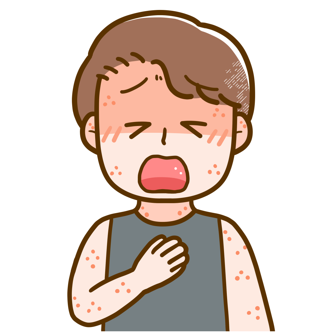 アナフィラキシーショック野田市 小児科 千葉県 こどもの花粉症 こどもの漢方 喘息 アトピー性皮膚炎 アレルギー 結節性痒疹 たんぽぽこどもクリニック