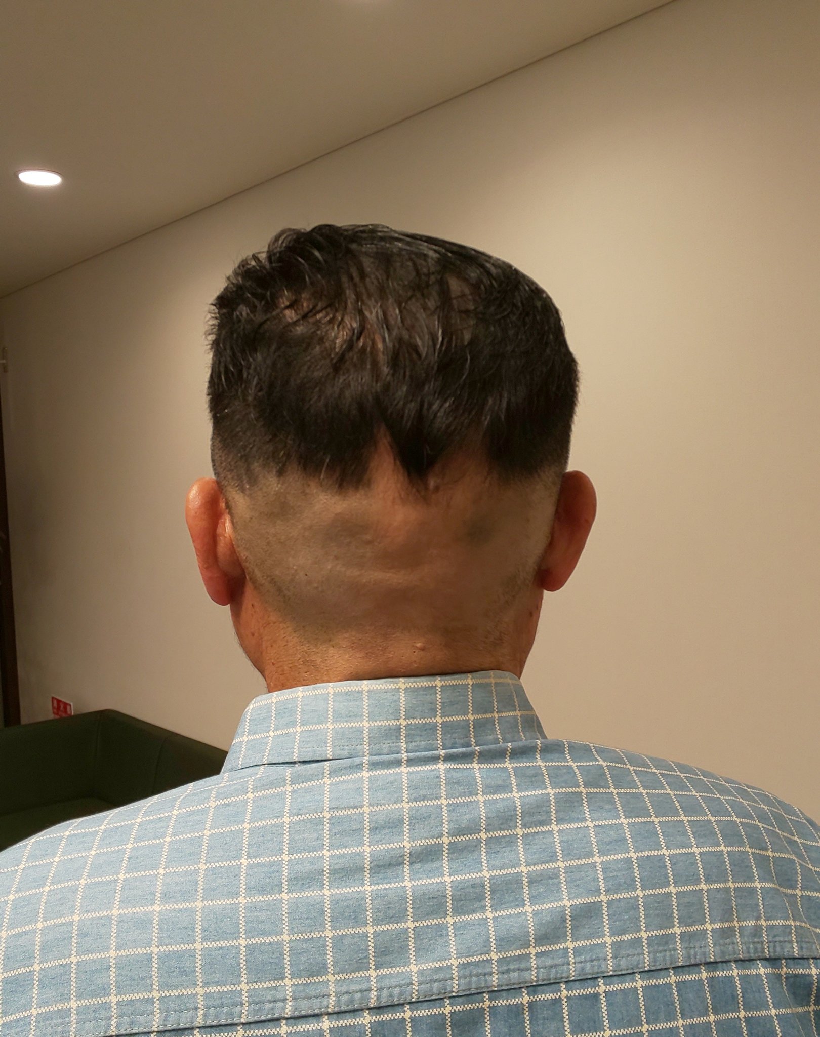 漫才師・トミーズ雅 60昨年11月の右頭部動静脈瘻手術に続き 3月17日大腸がんの大手術indianlegendのブログ