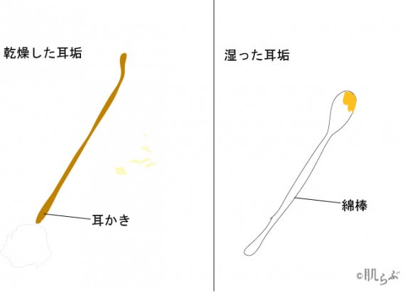 20代前半♀です。 - ワキガの自覚があります。耳垢も湿っています。耳- Yahoo!知恵袋