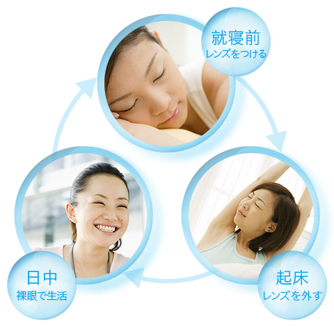 入会4ヶ月目で20年以上悩んだ乱視が改善された – 視力回復ビジョンサロントレーニングメガネ