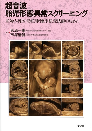 液浸標本:ヒト型海棲生物の胎児立体・オブジェ RottenRoddam 通販 239178Creema クリーマ