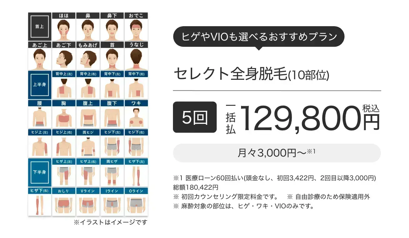 防府店限定 初回メンズ全身脱毛 2022年12月迄 ZERO防府 男の全身脱毛サロン