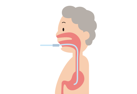 経管栄養M-Terrace