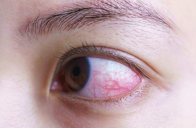 血眼イラスト - No: 1530378無料イラスト・フリー素材なら「イラストAC」